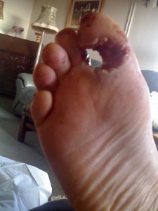This is what happens when foot fucking goes wrong folks.